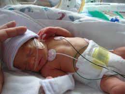 Research to Improve Preemie Survival Rates